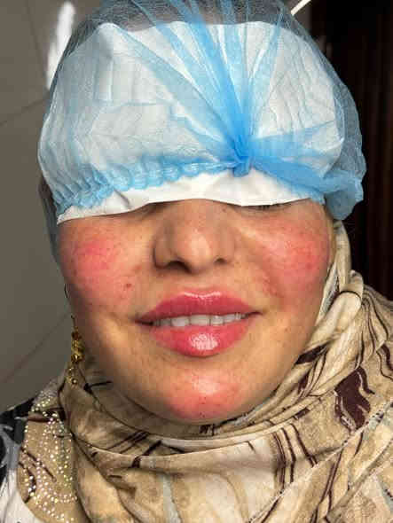 #عروض التغير الشامل فقط يمنا مع هدايا مميزة #عروض #رأس السنة ... التغيير الشامل بالفلر  مع نضارة.مجانية  وشغل اليوم اول مراجعه من ضمن عروض راس السنة..🍎🍎🍎🍎
مركز اوتار كلنك لطب الأسنان والتجميل 
العنوان الشموخ خلف مكتب الحنين للعقار داخل الفرع 
للحجز الاتصال على الرقم 
***********
                 https://www.instagram.com/p/DP_hUuQjKPC/?igsh=aTZwbW1nMmFoNW11
