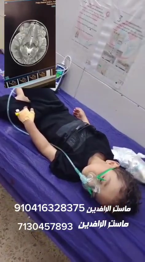 هذا حال الطفل عبدالله من كركوك حالته الصحية سيئة يحتاج تدخل جراحي في الدماغ يحتاج ٥ ملايين
رقم العائلة ***********
اذا متكدر توصلها اتصل على +***********
910416328375 ماستر الرافدين 
2150680862 ماستر الرافدين 
910416328375 ماستر الرافدين 
شارك المتشور 
#نبز_كركوكي
