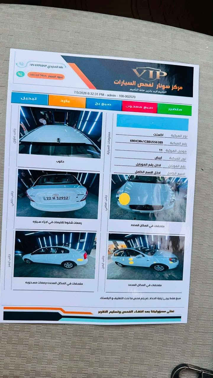 السلام عليكم
اكسنت دبدوب
وارد كوري

٢٠١١
رقم أربيل جديد

شرط التحويل

سياره كلين ما بيها صبغ تعديل بارد فقط

ماشي 183

تبريد ثلج

محرك أصلي 16 CVVT

بيها كابون بانزين

شرط التحويل

سعرها ١١٣
مكاني موصل أيسر
شراي تصال على الأرقام
***********
***********
