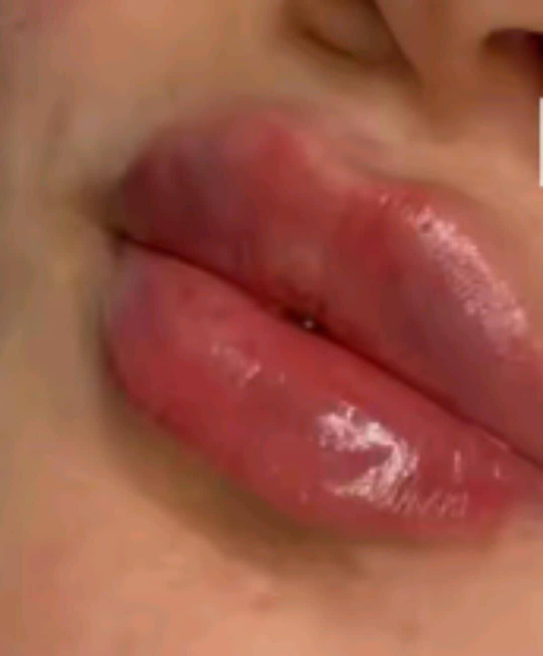 عروض الفلر نوعيته كلو بلاص الفرنسي ،والايطالي السيسي 50البلازمه المفعله بي اربي 30الجلسه والبوتوكس الكندي 40 وتغير وجه كامل  بلفلر  250 والغمازه 25 والبرنسك 25باختصاص دكتورة بنات هاي عروض بصالون الانيقه ***********
