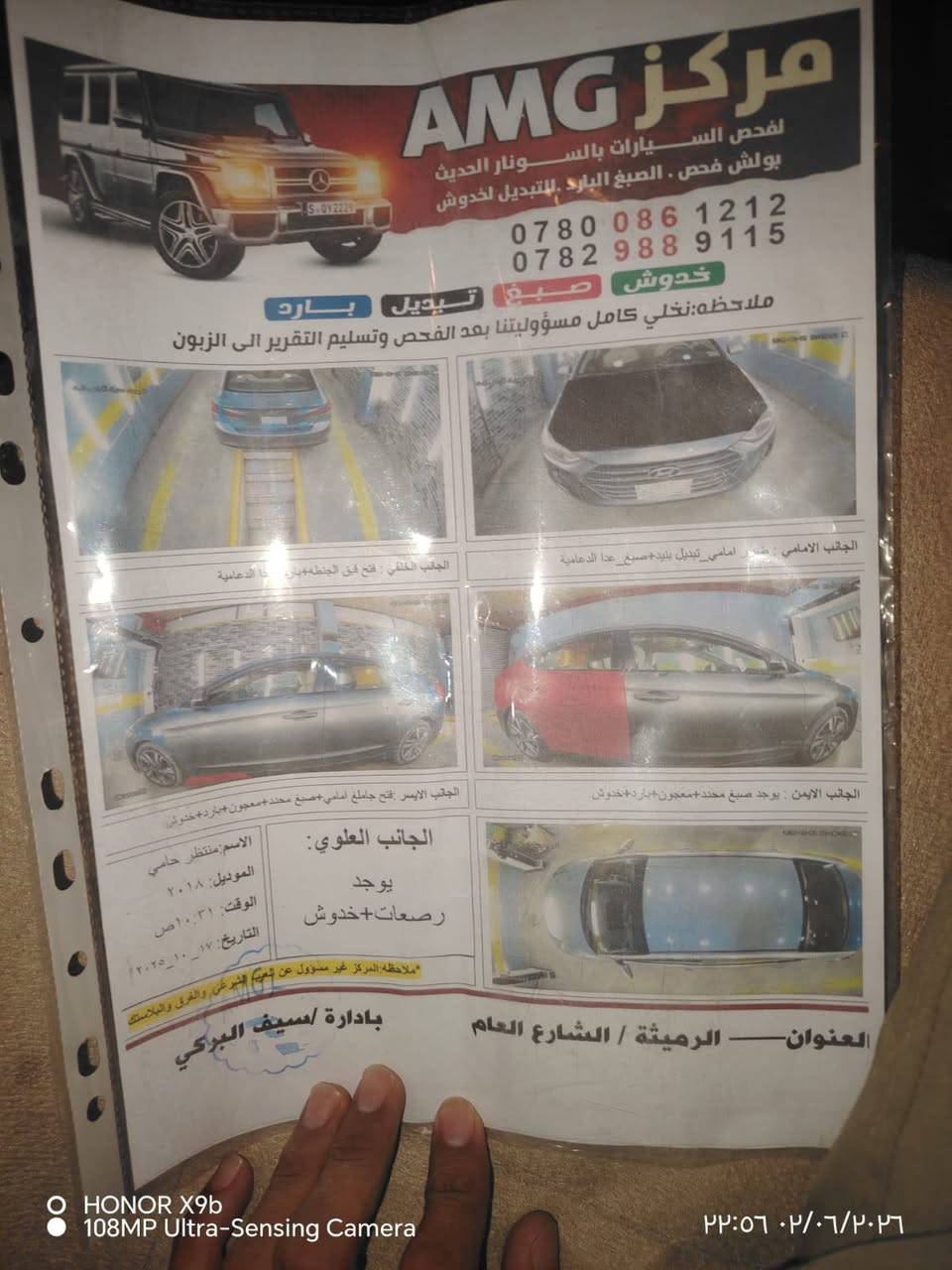18خليجي
مكينه2000
رقم نجف
مداور ثاني يوم
السعر ١٢٨وبيه مجال 
السونار مرفق معه الصور
***********
