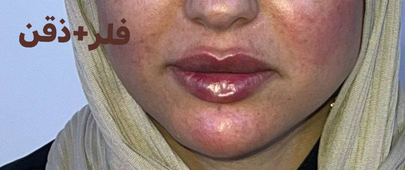 عروضنه الحلوه
فلر ديلوكس ب 50 الف
فلر براند لكوري ب 75
4 سيسي فلر 240
6 سيسي فلر 360
8 سيسي فلر480
10 سيسي فلر600


**إذا كنت صاحب هذا الإعلان وتريد حذفه لأي سبب، رجاءا أرسل رسالة إلى الدعم الفني**