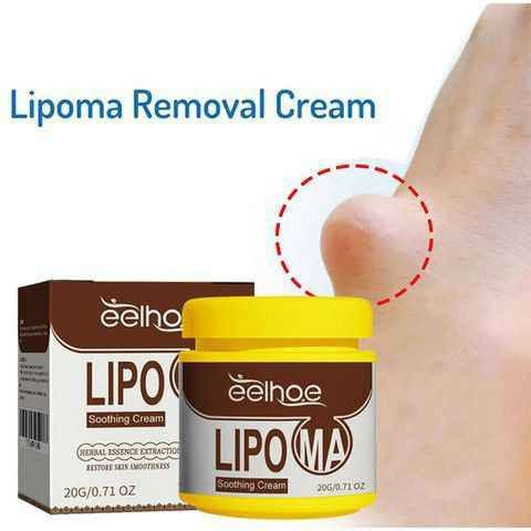 كريم إزالة الأورام الشحمية

السعر 8  الالفف

 منFDTY eelhoe LIPOMA.   Soothing Cream HERBAL ESSENCE EXTRACTION) RESTORE SKIN SMOOTHNESS
✨ كريم طبيعي بالأعشاب لإزالة الأورام الشحمية الفوري، للتكتلات تحت الجلد وتجمعات الدهون المختلفة، ولتخفيف الألم.

✨إزالة الأورام الشحمية: يُفتت الدهون الزائدة ويُحفّز تكوين العقيدات تحت الجلد. بفضل هذا المنتج، يُمكنك إزالة الأورام الشحمية بفعالية ودون أي مضاعفات.

✨ كريم عميق التغلغل وسهل الامتصاص يُخفف الانزعاج. تركيبة طبيعية غير دهنية تُذيب الأورام الشحمية دون جراحة.

✨يُحسّن الدورة الدموية يُساعد على  التخلص من الأورام الشحمية في الأوردة عن طريق تعزيز الدورة الدموية وتقليل الضغط. كما يُمكنه تخفيف أعراض دوالي الأوردة وتحسين الدورة الدموية في النهاية.

✨ تأكد من أن المنطقة المُصابة نظيفة وجافة. ثم دلكي الكريم بلطف بيديك من مرتين إلى ثلاث مرات يوميًا للحصول على أفضل النتائج.
#الاصلي 💯✅ 

🚘يوجد خدمة توصيل لجميع محافظات العراق ٤ الاف 🚘 كربلاء, العراق


**إذا كنت صاحب هذا الإعلان وتريد حذفه لأي سبب، رجاءا أرسل رسالة إلى الدعم الفني**