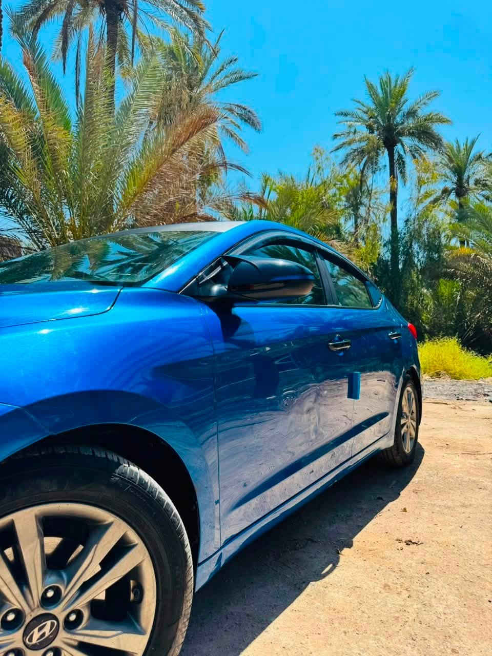 السلام عليكم ورحمة الله وبركاته
للبيع  ألنترا 2018 وارد أمريكي

🔹 المحرك: 2000 DOHC – مكفول.

🔹 الگير: AT (الأوتوماتيك المرغوب) – مكفول.

🔹 اللون: أزرق بحيري والرقم بغداد إنكليزي لوحات جديدة و السيارة باسمي والتحويل ثاني يوم والسنوية سارية لغاية 2031.

🔹 الممشى: 90 ألف كم والهزّة جديدة.

✅ المحرك مكفول والگير مكفول.

✅الشواصي مكفولة 

ملاحظات ضررها : 

* السيارة بيها چاملغ جهة السائق الأمامية مبدل حادث أمريكا 

* والبنيد مصبوغ يعني السيارة قطعتين فقط قطعة تبديل وقطعة صبغ.

📍 مكان السيارة: محافظة بابل.

💰 السعر 120 وبيها مجال قليل. والسونار جديد موجود للاستسفار خاص او الاتصال على الرقم. 
***********
