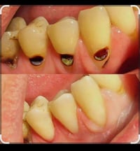 حشوة مجانية • جامعة الهادي • كنيسة بولص وبطرس