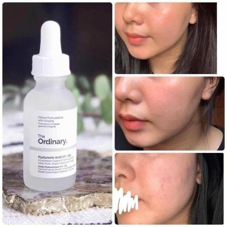 سيروم اوردنري || Ordinary serum

🤍السيروم الابيض🤍
‏Niacinamide 10% + Zinc 1%

الفوائد 👇🏻
🤍 يعالج الكلف والتصبغات العنيده والنمش.
🤍 محاربة علامات التقدم في العمر والتجاعيد والترهلات 
🤍 يعمل على زيادة نضارة البشرة وحيويّتها بشكل ملحوظ
🤍 ويزيد من تورّد الوجنتين  وعلاج صفار الوجه وشحوبه
🤍 ترطيب عميق جدا

طريقة الاستعمال👇🏻
يستعمل مرة واحدة يومياً على كامل الوجه ويترك على الوجه 30 دقيقة
متوفر الاصلي ومتوفر كوبي درجه اولى

#توصيل لجميع محافضات العراق،

للحجز او الاستفسار مراسله الصفحة


**إذا كنت صاحب هذا الإعلان وتريد حذفه لأي سبب، رجاءا أرسل رسالة إلى الدعم الفني**