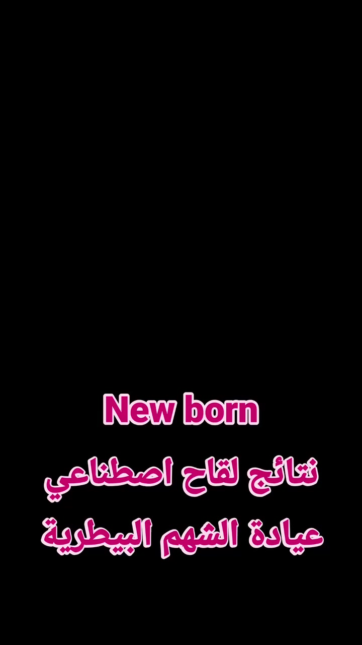 اليوم بحمد الله وتوفيقه ولدت ثمرة من ثمار التلقيح الاصطناعي في عيادة الشهم البيطرية 🤍
عجل من جنس سمنتال نقي 100% 🐄✨
خطوة جديدة نحو تحسين السلالات وزيادة الإنتاجية وجودة القطيع 💪
نسأل الله البركة لأصحاب الحلال، ودائماً نسعى للأفضل بخدمتكم.
📍 عيادة الشهم البيطرية – كركوك / الحويجة
للاستفسار والحجز يرجى التواصل على رقم العيادة *********** #fyp #reels #share #اكسبلور_explore #reel #viralreels #viralnews #reelvideo #reelviral #reelindia #reelsinstagram #reelstrending #reelsvideo #trending #trendingaudio #trendingsongs #viralpost
