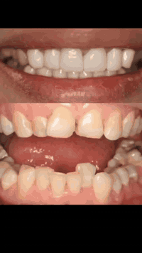 عيادة خداداد • زراعة وتجميل أسنان • خانقين تولة فروش