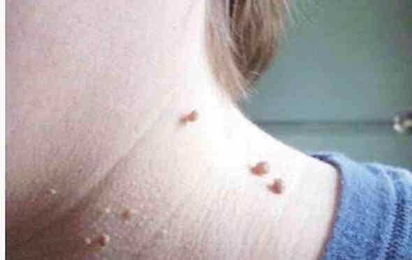 عيادة المتميزين التمريضيه (الرجال . والنساء )

🌸 إزالة الزوائد اللحمية الجلدية النسائية بكل أمان وراحة 🌸

هل تعانين  من الزوائد اللحمية و الجلديه 
🌸 إزالة الزوائد  اللحميه و الجلدية النسائية بكل أمان وراحة 🌸
الآن يمكنك التخلص منها بسهولة مع جلسة إزالة دقيقة وآمنة دون ألم يُذكر

✨ مميزات الخدمة:

إزالة سريعة خلال دقائق

بدون جراحة وبدون نزيف

أدوات معقمة ومعتمدة

خصوصية تامة للسيدات

نتائج فورية واستعادة الثقة من أول جلسة

✨ مناسبة لـ:
الزوائد الجلدية – الزوائد اللحمية – ( الرجال اي يوم )

📍 للسيدات فقط – حجوزات – سرية تامة
📞 للتواصل والحجز: (***********)
📆 م – موقع قريب من
 شارع الخليج بصف البنزين خانه الداخلية بصف همبركر خيري بصف همبركر حسوني بصف صيدلية ركن الخليج 

💗 لأن راحتك وجمالك أولويتنا 💗
