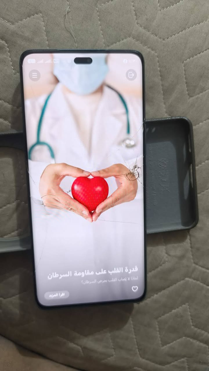 جهاز هونر اكس 9سي شاشه مفطره بس مابي شي لا تعليك ولا شي وياه كرتونه وشاحنه وسماعاته سعر 270☺️


**إذا كنت صاحب هذا الإعلان وتريد حذفه لأي سبب، رجاءا أرسل رسالة إلى الدعم الفني**