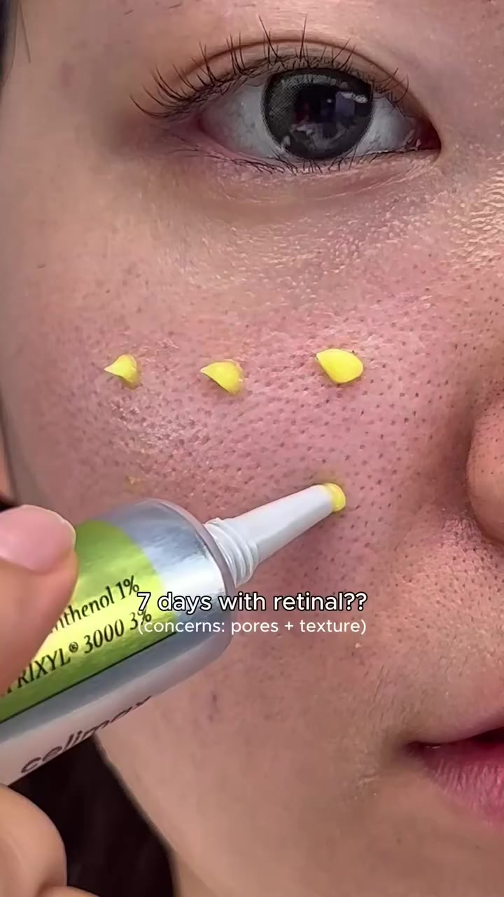 سيروم ذا فيتا ريتنال شوت لشد البشرة من سيليماكس - 15مل

خطوة صغيرة بسيروم، فرق كبير في بشرتك

فعالية المنتج:

يمنح بشرتك شدًّا واضحًا ويعيد لها مظهرها المشدود والشاب.
يعزز مرونة الجلد بفضل قوة الريتنال والمغذيات النشطة.
يساهم في تقليل التجاعيد العميقة والخطوط الدقيقة تدريجيًا.
يقدم عناية مركزة لتفتيح بشرتك الباهتة ومنحها توهج طبيعي.
يجدد خلايا البشرة ويحفّز دورتها الحيوية لتصبح أكثر امتلاءً ونضارة.
يقلل من علامات الشيخوخة المبكرة الناتجة عن العوامل البيئية.
يمنح بشرتك ملمسًا ناعمًا وحريريًا مع ترطيب متوازن.
يساعد على استعادة حيوية بشرتك المرهقة والمتعبة.
يقدم عناية مركزة لشد المسام وتحسين مظهرها.

مميزات المنتج :

يحتوي على الريتنال النقي المعروف بفعاليته العالية في شد البشرة ومحاربة التجاعيد.
غني بالفيتامينات والعناصر المغذية لاستعادة إشراقة البشرة.
قوام خفيف سريع الامتصاص لا يترك أي أثر دهني.
تركيبة لطيفة تناسب معظم أنواع البشرة، بما فيها البشرة الحساسة (مع الاستخدام التدريجي).
مركّز بجرعة فعالة تمنح نتائج واضحة بمرور الوقت.
عبوة عملية صغيرة (15مل) مثالية للسفر والاستخدام اليومي.
مدعوم بتقنية سيليماكس للعناية المكثفة بالبشرة لمظهر صحي ومشدود.
يمنح نتائج مزدوجة: شد + ترطيب + تفتيح في منتج واحد.

طريقة الاستخدام:

نظفي بشرتك جيدًا وجففيها بلطف.
ضعي 2–3 قطرات من السيروم على الوجه والرقبة.
دلّكي بلطف بأطراف الأصابع حتى يمتصه الجلد بالكامل.
استخدميه في المساء فقط (لأن الريتنال يتأثر بالشمس).
ابدأي باستخدامه مرتين إلى ثلاث مرات في الأسبوع، ثم زيدي تدريجيًا حسب تحمل بشرتك.
لا تنسي تطبيق كريم مرطب بعده للحفاظ على ترطيب البشرة.
في النهار، احرصي دائمًا على استخدام واقي شمس لحماية البشرة.


**إذا كنت صاحب هذا الإعلان وتريد حذفه لأي سبب، رجاءا أرسل رسالة إلى الدعم الفني**