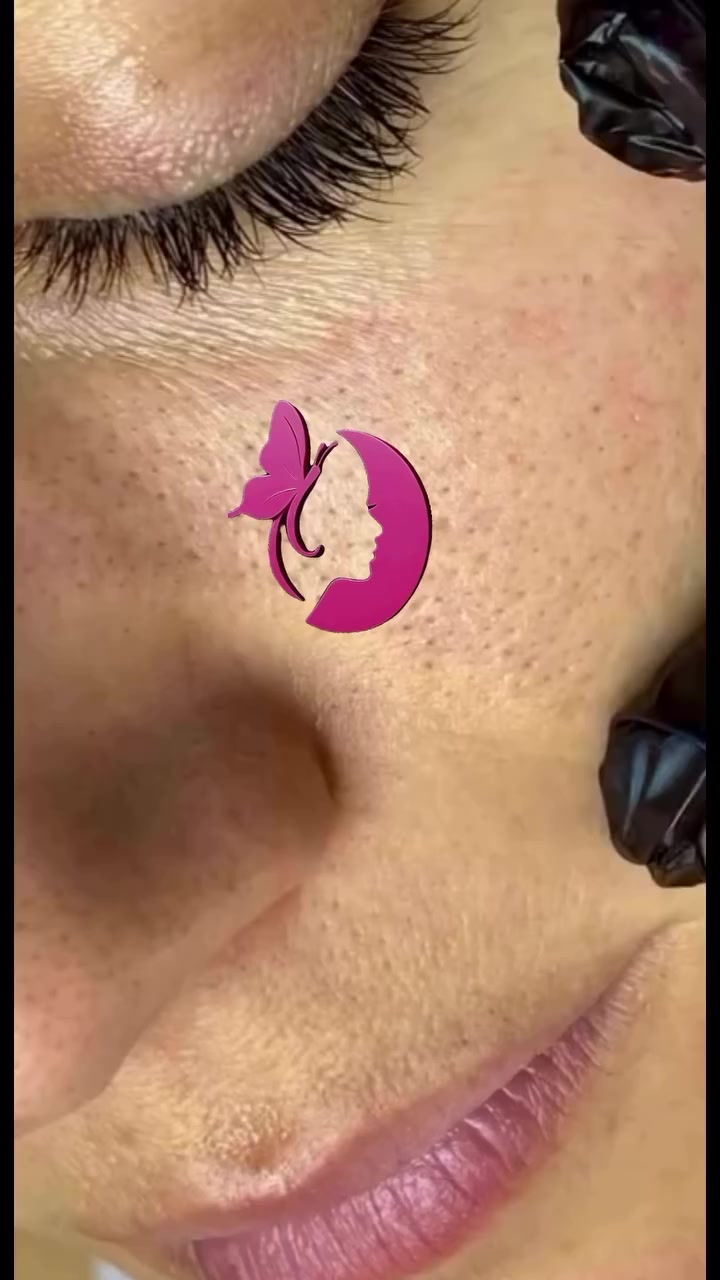 ✨ الجلسة الملكية لتنظيف البشرة ✨ 

وداعاً للرؤوس السوداء والمسامات المزعجة 👋 
نرجّع لبشرتج النعومة والنظافة والإشراقة من أول جلسة 💆‍♀️ 

شاهدي الفرق بنفسج قبل وبعد 👑 
تنظيف عميق + تعقيم + عناية خاصة حتى تطلع البشرة صافية ومشرقة. 

🎁 عرض العيد مستمر لغاية قبل العيد بـ 3 أيام فقط 

وهدية العيد من صالون فراشة لبنان 🎀 
أي زبونة تجيب 3 زبونات لتنظيف البشرة تحصل على جلسة ملكية مجانية 🤍 

دللي نفسج وخلي بشرتج تستقبل العيد بإشراقة مختلفة ✨ 

📍 صالون فراشة لبنان 
📞 *********** 

#تنظيف_بشرة 
#جلسة_ملكية 
#العناية_بالبشرة 
#العيد_قريب 
#صالون_فراشة_
