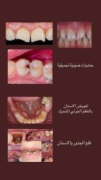 عيادات جامعه العميد كربلاء • خدمات اسنان • شغل مجاني