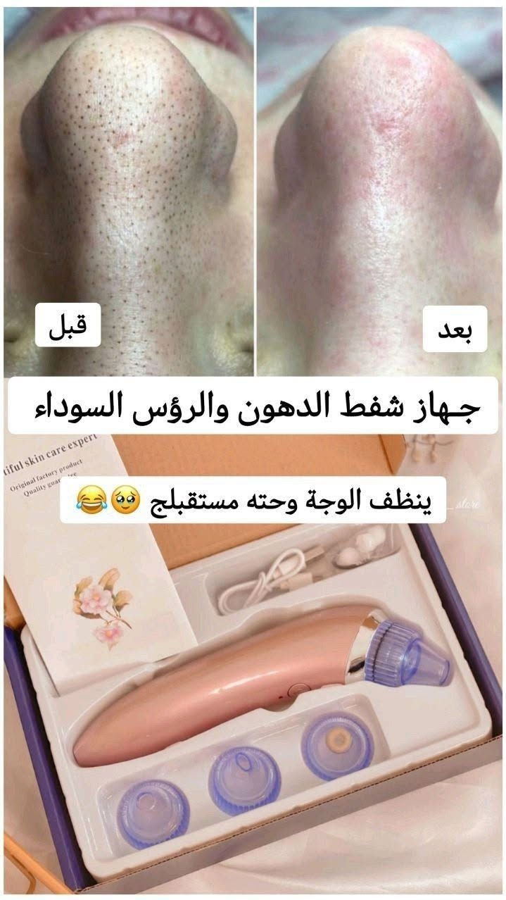 عرض خاص 😍😍
⚫جهاز شفط الدهون من الوجه✔️✔️
⭕ماركه اوربيه  ⭕
جهاز ازالة الدهون والرؤس السوداء من الوجه
متعدد الروؤس لكل راس عمل معين
للمسامات الواسعه 
والمتوسطه 
والحساسه 
تنظيف البشرة من التراكمات التي تسبب البثور
@إشارة #جميع #الشعب #يوجد #توصيل #الكافه #المحافضات#العراق


**إذا كنت صاحب هذا الإعلان وتريد حذفه لأي سبب، رجاءا أرسل رسالة إلى الدعم الفني**