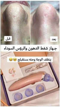 جهاز شفط الدهون • ازالة الرؤوس السوداء • تنظيف الوجه • جهاز بشرة • مسا...