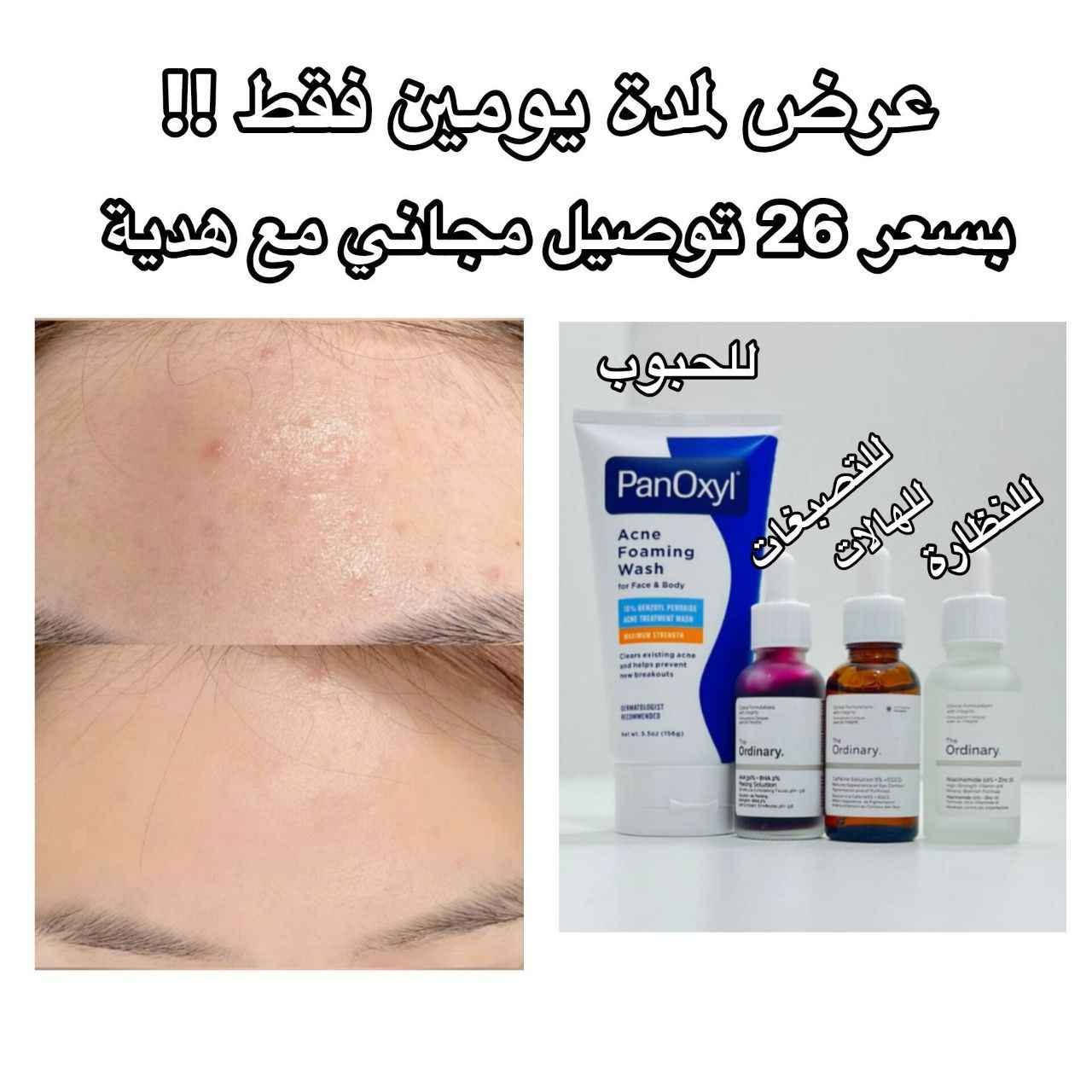 ‎منتجات للبشرة‎ بغداد, العراق


**إذا كنت صاحب هذا الإعلان وتريد حذفه لأي سبب، رجاءا أرسل رسالة إلى الدعم الفني**