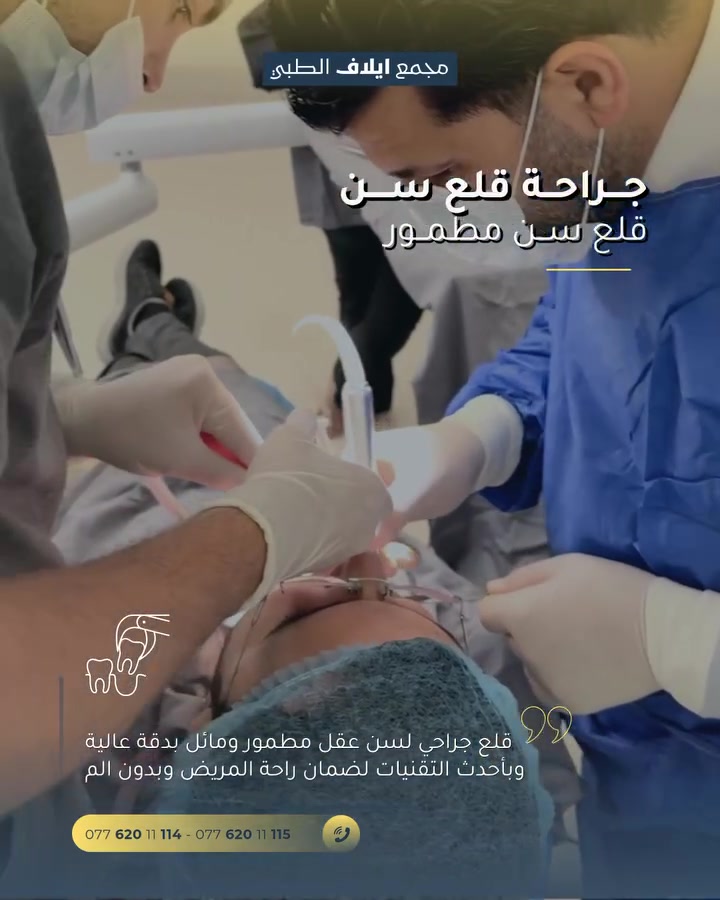 السن المطمور قد يتسبب في الضغط على الجذور المجاورة، أو يؤدي إلى حدوث التهابات متكررة في اللثة وصعوبة في التنظيف. 
لذلك، فإن إزالته في الوقت المناسب تقيك من مضاعفات آلام الفك والصداع المزمن.

نقدم لكم في قسم طب وجراحة الأسنان بمجمع إيلاف الطبي حلولاً جراحية دقيقة وآمنة لقلع وتدبير السن المطمور بأيدي أطباء اختصاصيين، مع توفير رعاية متكاملة تضمن راحتكم وسلامتكم.

📞 للتواصل والاستفسار، اتصلوا بنا:
*********** – ***********
📍 العنوان: خانقين - شارع البريد - قرب مول التفاح الأخضر.
🌟 لأن صحتك تستحق الأفضل.
#مجمع_إيلاف_الطبي #قلع_الأسنان #سن_العقل
