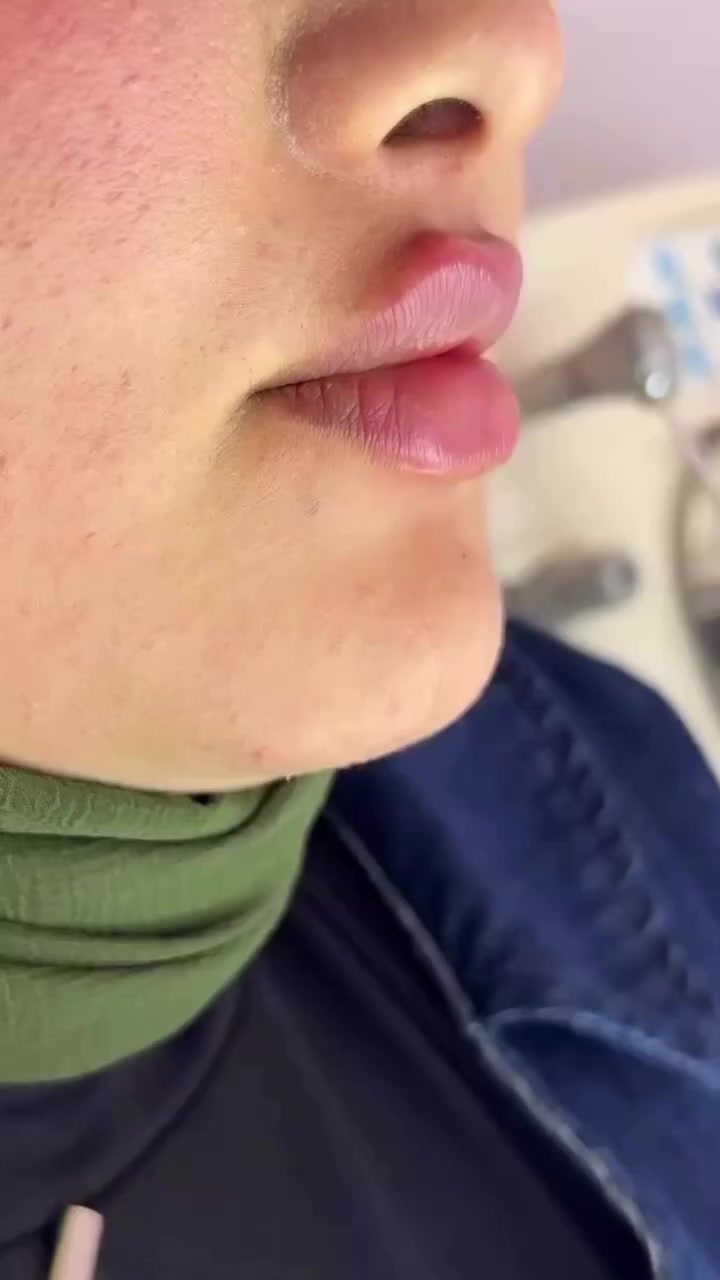 مسابقة شهر رمضان🌙😍
راح اختار ست فائزات وهواية هدايا 😍•
الاولى فلر شفه
الثانية فلر وجه
الثالثة بوتوكس
الرابعة ابرة نضارة وتفتيح
الخامسة تنظيف بشرة
السادسة جلسة ليزر لمنطقة بالجسم
⭕️الشروط •0•
 و متابعة للحسابات عيادة الدكتور منتظر والدكتورة مروة لطب الأسنان والتجميل العيادة التخصصية

•تاك لاكثر عدد من صديقاتكم يتابعون حسابي وبقية الحسابات
• مشاركة المنشور ستوري يمكم وتسوولنا تاكات
المسابقة تستمر اسبوع والسحب عشوائي ع اللي مطبق جميع الشروط حصراً


**إذا كنت صاحب هذا الإعلان وتريد حذفه لأي سبب، رجاءا أرسل رسالة إلى الدعم الفني**