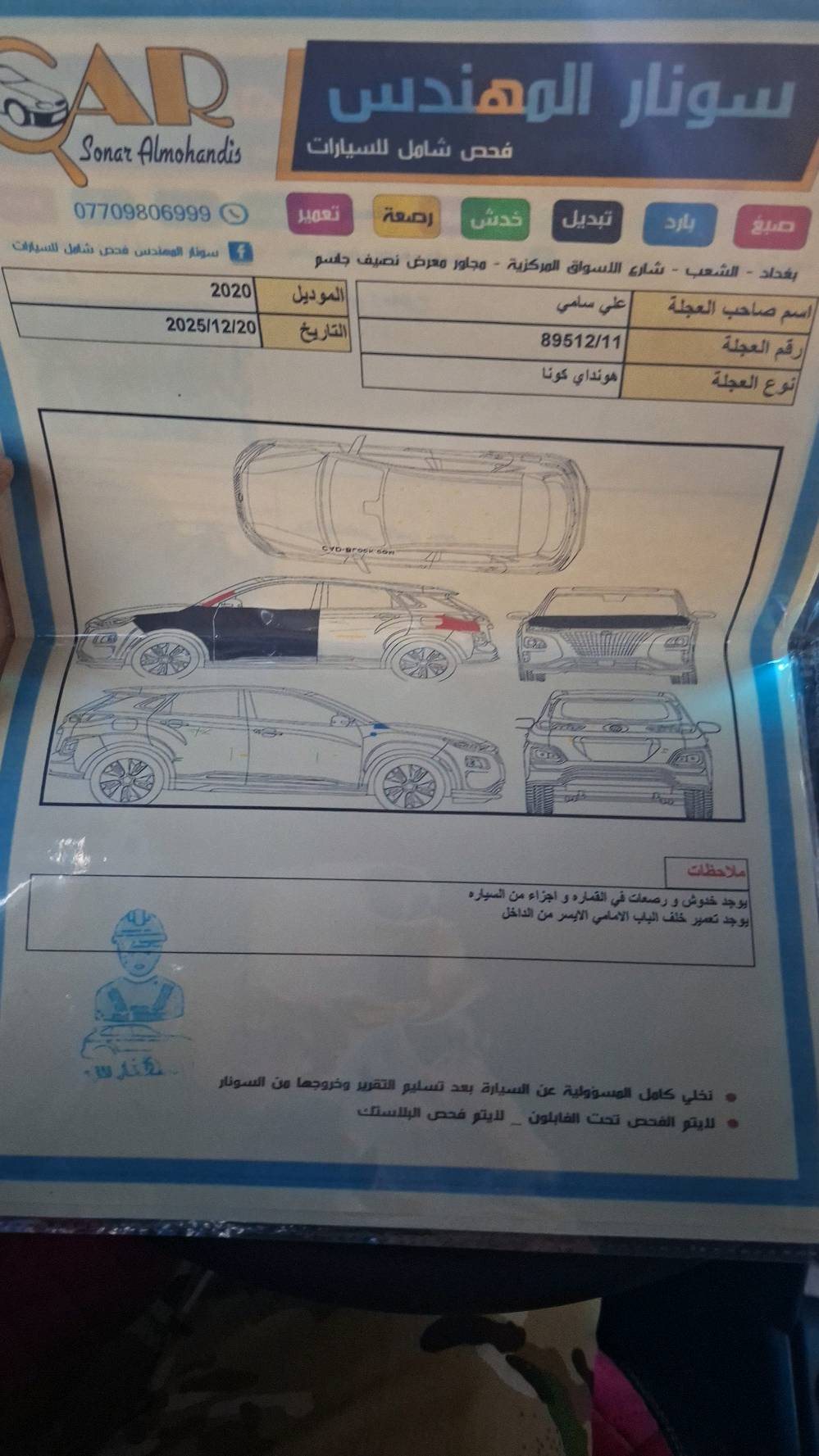 كونا امريكي ٢٠٢٠
السونار مرفق مع الصور
ماشية86.000