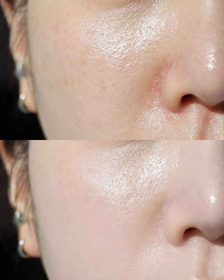 🫶 عرض جمال الكورس متكون 💫🫶

من عصارة ميلانو+عصارة نيويورك مع الصابونه حبيبتي تريدين وجهج  يصير زلال بالسمن وبياض بنفس الوقت..
. تعانين من الكلف تعانين من
التصبغاات عندج هالات سود تحت العين وتريدين الحل 👩‍🦳وتريدين شي يخلصج من كل هاي المشاكل موجود وراح يخليج تستغنين عن المكياج 💄
العرض مكون من 
عصارة نيوريورك
صابونة نيويورك
وعصارة ميلانوو
وهي نتائج للزبائن المتجر

#توصيل_كافة_المحافظات العراق
👈🏻💌اي استفسار او الحجز👇🏻
 *********** بغداد, العراق
