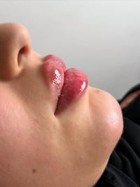 🎉 بمناسبة بداية عام جديد 🎉 سوّينا لكم عرض الفلر الكوري ✨ 💉 1 سي سي — ب...