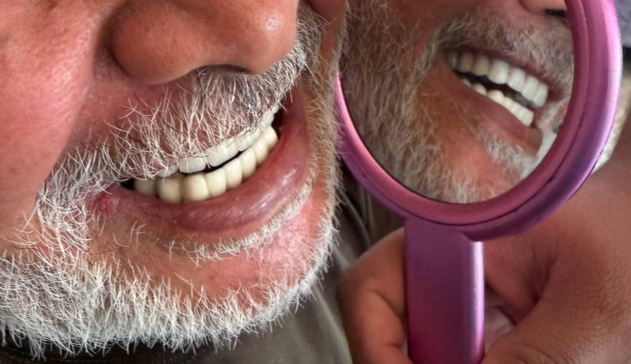 ابتسامتك المثالية صارت أقرب إلك ✨
خصومات خاصة على ابتسامات الأسنان لفترة محدودة 😁🦷
▪️ الزيركون
▪️ الإيماكس
▪️ والسيراميك 
المختبر الابداع السوري  لصناعة الاسنان
و التعويضات السنية وتركيب الأسنان
وبأنسب الاسعار بجميع المحافظات
العراقية 
ملاحظة لدينا كادر يزور المريض للبيت ويتم العمل في المنزل 
للتواصل والحجز. ***********»꧁꧂«***********
