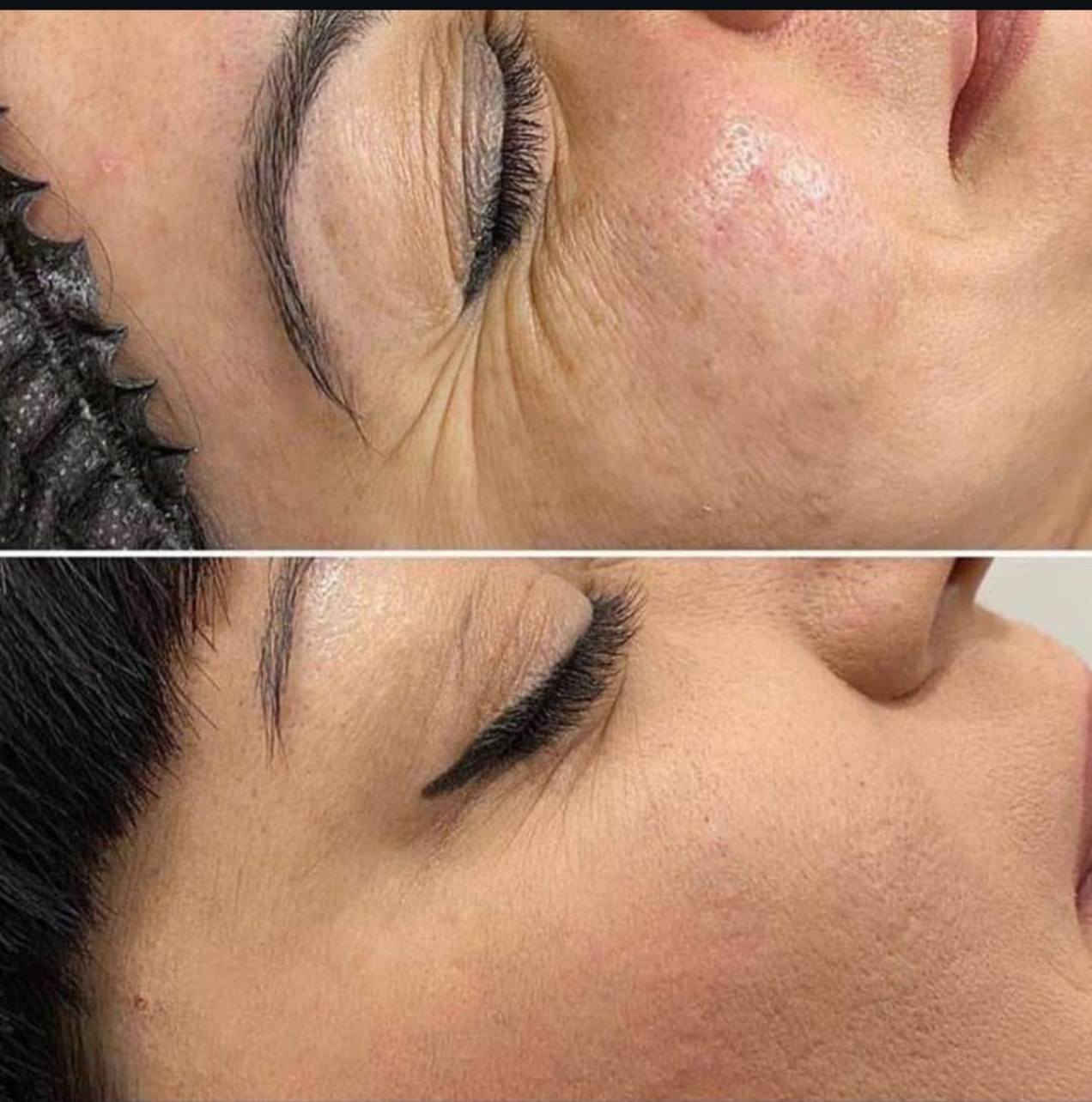 مسالخير...
مدربة تجميل وحقن سورية بالعراق من 4 سنوات  ... 

حاليا #مسؤلة_القسم_الطبي_ بفندق كورال الجادرية بمركز تجميل رجالي .

طلبات حقن منزلية بنص السعر ... 

أيضا دورات تدريب التجميل والبشرة  مع شهادات بريطانية أو بدون شهادات 💚⚡👑.
#للتواصل_خاص.


**إذا كنت صاحب هذا الإعلان وتريد حذفه لأي سبب، رجاءا أرسل رسالة إلى الدعم الفني**