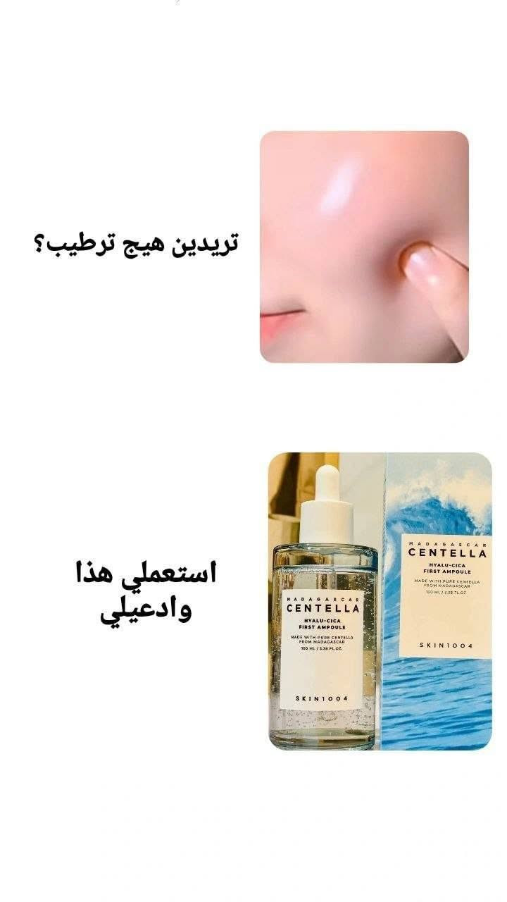 #ستوريات


**إذا كنت صاحب هذا الإعلان وتريد حذفه لأي سبب، رجاءا أرسل رسالة إلى الدعم الفني**