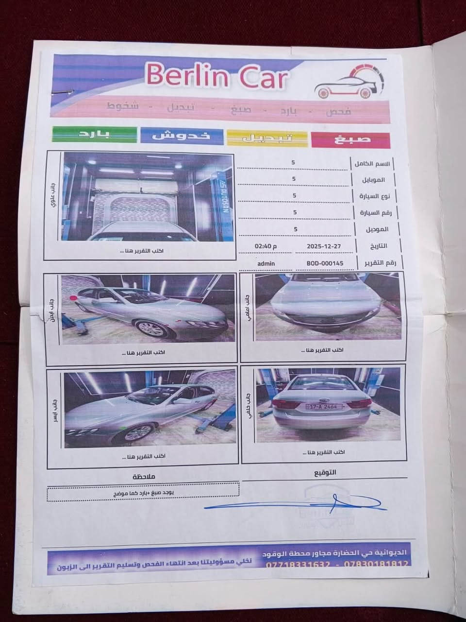 اوبتيمه 2009السياره بيه صبغ قليل جاملق الخلفي سياره نضيفه كفاله كير مكينه حداديه تبريد تخم تاير جديد سياره جديده ونضيفه مداور ثاني يوم السعر 95 وبيه مجال هاذه رقم راعيه وبيه خير ويدلل الشراي***********
