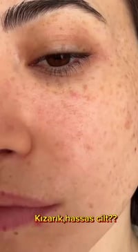 سيروم اكول بيري • PDRN • 30 مل