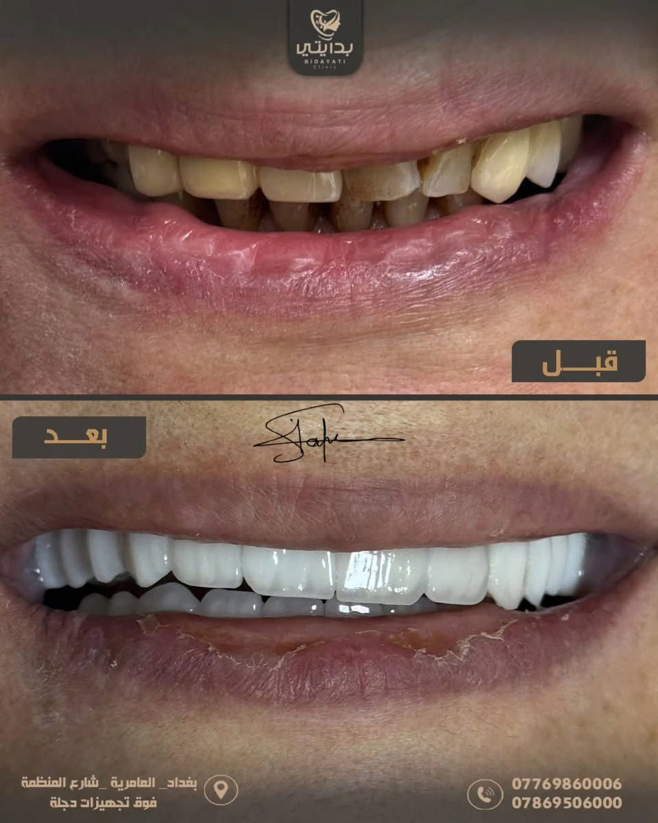 ⁨ ⁨ ⁨ عيادة بدايتي ✨🤎
📍 العامرية – شارع المنظمة – فوق مستلزمات دجلة
📞 *********** – ***********⁩⁩⁩
