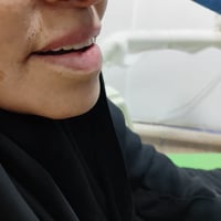 تعويضات اسنان • تراكيب اسنان • ذي قار شارع بغداد