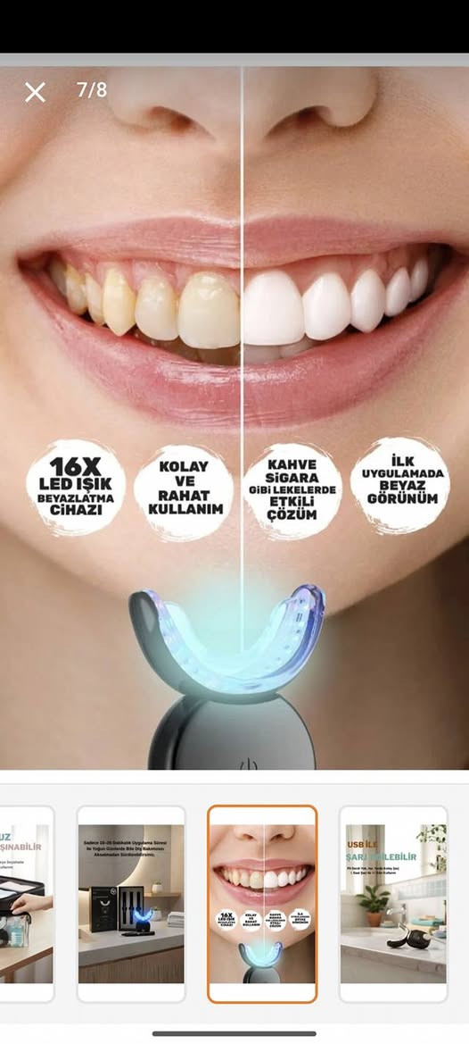 جهاز تبيض الاسنان اكتبلي 25 مع التوصيل 
لاول تم


**إذا كنت صاحب هذا الإعلان وتريد حذفه لأي سبب، رجاءا أرسل رسالة إلى الدعم الفني**