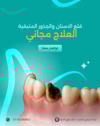 علاج مجاني • قلع الجذور • خلف مول الحارثي