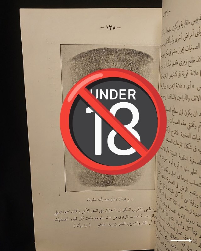 "مرجع طبي تراثي نادر في علم الأمراض السريرية والعلاجات الكلاسيكية!"
🌍
📜
🩺
🩸
📘
(كتاب الأمراض التناسلية وعلاجها وطرق الوقاية منها)
تأليف: الدكتور فخري (طبيب الجلد والأمراض التناسلية).
⚜️
📚
ناشر الطبعة: المطبعة العصرية ومكتبة الخليل لصاحبها خليل الخليلي - مصر
🇪🇬
.
✨
عن هذه النسخة التراثية:
سنة الطبع: 1960-1970
الحالة: ممتازة
✅
الموضوع:
كتاب طبي تاريخي وتخصصي رصين يستعرض بدقة علمية كلاسيكية منظومة الأمراض التناسلية والجلدية الشائعة وطرق تشخيصها السريري وعلاجاتها الدوائية والوقائية المعتمدة في القرن الماضي، يهم جداً أطباء الجلدية والتناسلية، طلاب كليات الطب والصيدلة، الباحثين في تاريخ العلوم الطبية، وهواة اقتناء المخطوطات والمراجع الطبية التراثية النادرة.
للحجز
🔻
:
البوت:
@PH_900bot
أو واتساب: ***********
