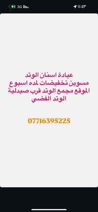 الوتد الفضي • توصيل سريع • مجمع وتد بسماية