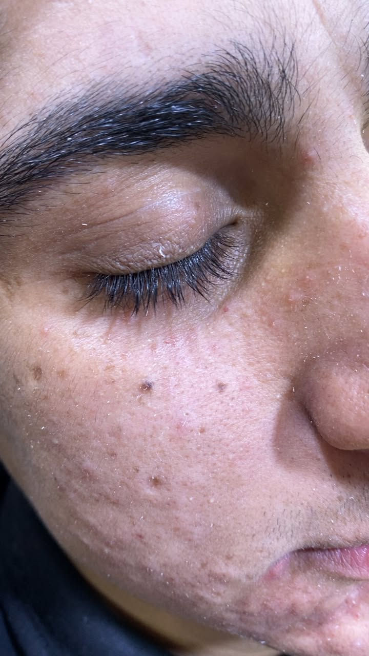 تعاني من الرؤوس السوداء والبشره الدهنيه🧏🏿🧏🏻

ماعليك بس تحجز 📞📞
ازاله الرووس السوداء 
التقشير المائي وازاله الدهون🧑🏻‍🔬
التقشير الكاربوني 🧔🏻‍♀️
للحجز مراسله الحساب او الاتصال 
***********📞
