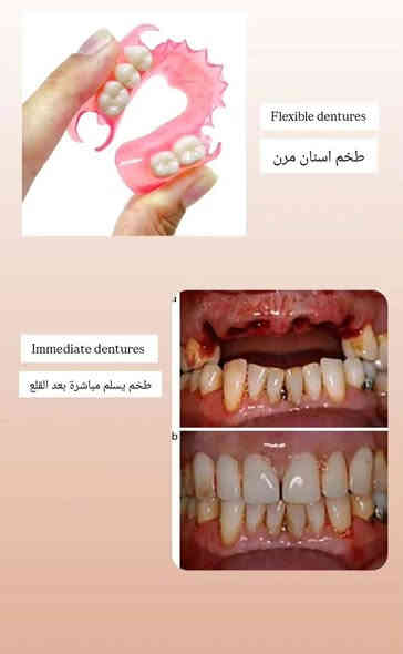 نقلاََ عن الشيخ غانم حازم الراشدي تعلن طلبة كلية طب الأسنان عن استقبال المواطنين في مقر الكلية
علما ان أجور العمل مجانيه عدا أجور المختبر لجميع الحالات المذكورة أعلاه... للراغبين الاتصال على الرقم *********** مع تحياتي والسلامه والعافيه للجميع
