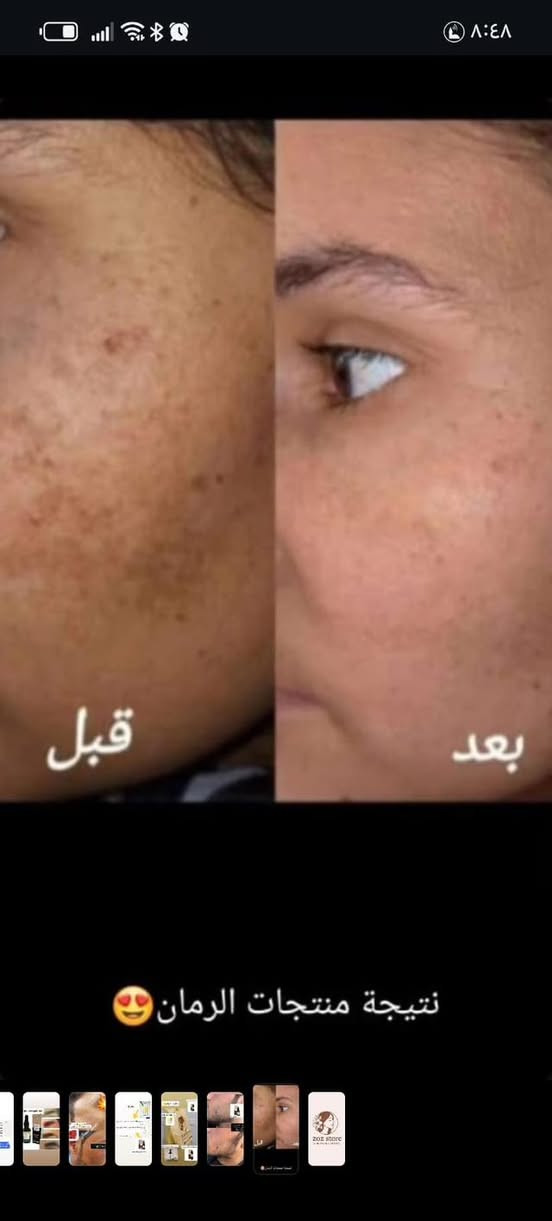 السلام عليكم ورحمه الله منتجات نضاره ومبيضات واقي شمس مفعول يجنن  بكج كامل لشعر واسعار مناسبه


**إذا كنت صاحب هذا الإعلان وتريد حذفه لأي سبب، رجاءا أرسل رسالة إلى الدعم الفني**