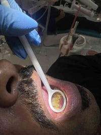 علاج مجاني • تنظيف أسنان • الناصرية-شارع النيل