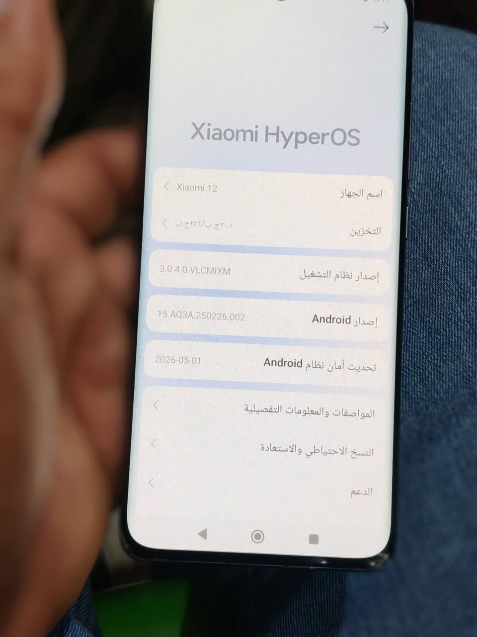السلام عليكم للبيع 0771408050
شاومي. 12 g5
ذاكره 256 +12
ملحقاته كامله
مكاني عفج
السعر 215


**إذا كنت صاحب هذا الإعلان وتريد حذفه لأي سبب، رجاءا أرسل رسالة إلى الدعم الفني**