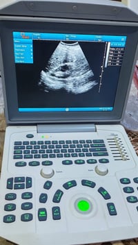 (( جهاز سونار للبيع )) - جهاز سونار نوع citymed مستعمل وبسعر مناسب جدا...