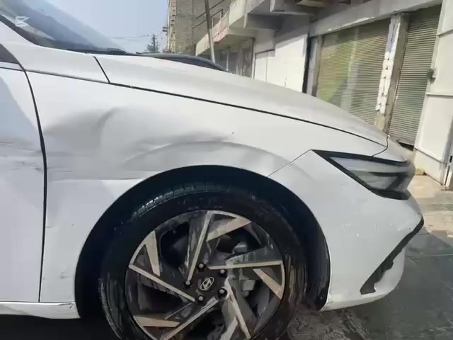 بغداد حي الجامعة شارع جامع نجمة مجاور أسواق ركن الخيرات *********** مستعدون لإصلاح اضرار الحالوب بتقنية جهاز ال بي دي آر الإلكتروني
