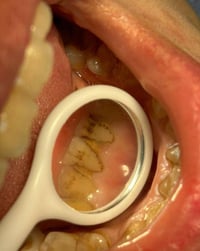 نستقبل المرضى في كليه طب الأسنان/شارع الكورنيش قرب مستشفى الأطفال  *(ا...