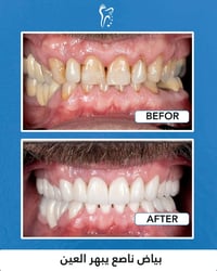 عيادة أسنان • تقويم أسنان • طويريج