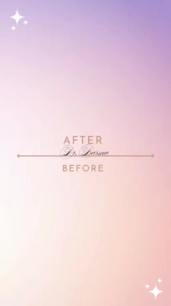 حشوات تجميليه ضوئيه للأسنان الاماميه نفس لون السن تماما
جمال... قوه...متانه
احجز موعدك واستمتع بابتسـامة صحيـة
📞 ***********
