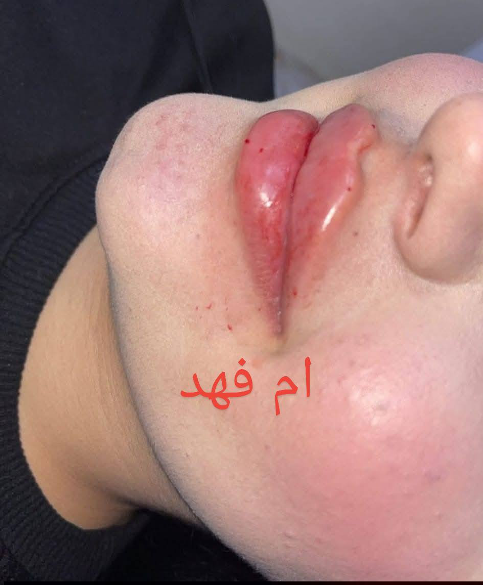 السلام عليكم بنات كوافيرا من بغداد مكاني حاليا نجف مهندسين شارع مطعم خيمه الخدمي قرب فندق قصر الياسمين اهلا وسهلا بكم ❤️ اي استفسار خاص او ع رقم *********** يشرفني حضوركم ...

