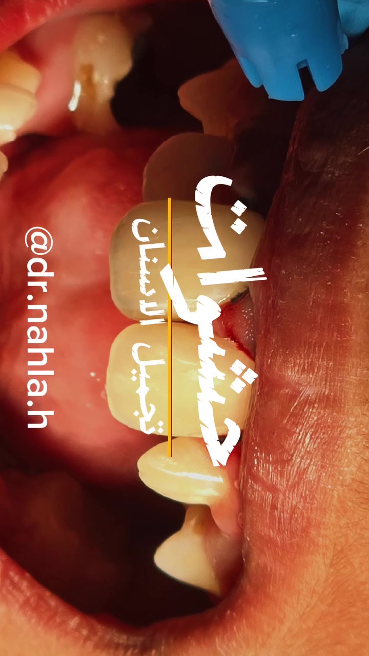 أحجز الان
***********

