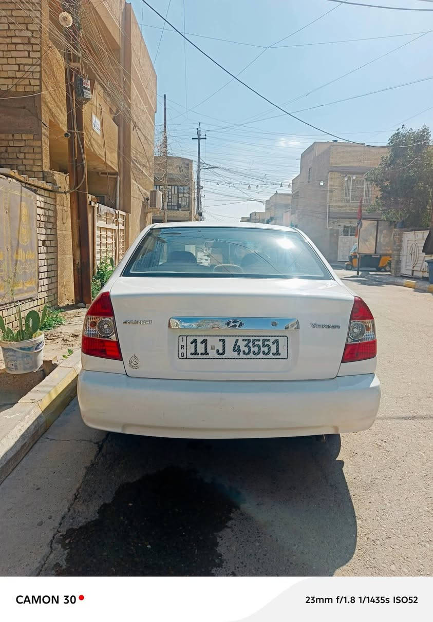 سلام عليكم
هونداي فيرنا خصوصي ابيض موديل ٢٠١٤ مكفوله باسمي تحويل ثاني يوم محرك جيد جدٱ لاتنقيص ولاتبخير كير وتبريد خير من الله السياره فقط الدعاميه الاماميه مصبوغه والباقي مكفول السياره ماشيه ١٩٠ كم المكان زعفرانيه اربع شوارع،، مبايل *********** السعر ٨٨ ورقه
