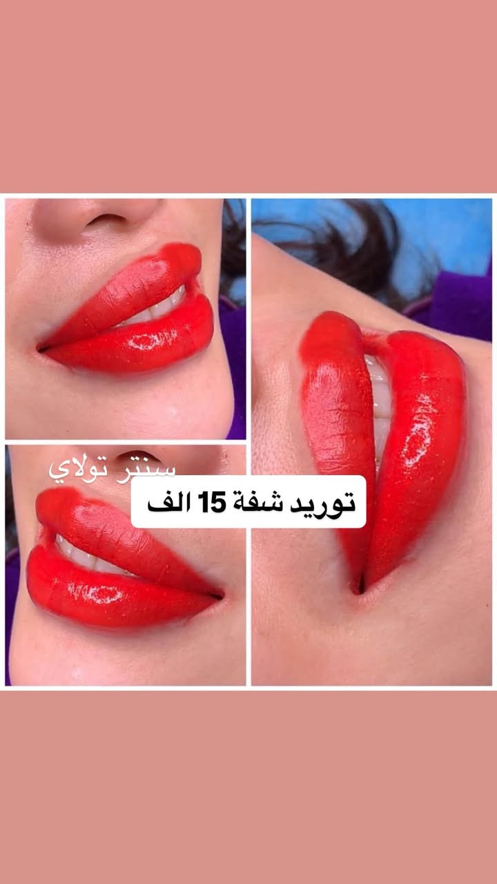 #اشاره شعارنا خدمه الجميع
#سنترتولاي #بنات


**إذا كنت صاحب هذا الإعلان وتريد حذفه لأي سبب، رجاءا أرسل رسالة إلى الدعم الفني**
